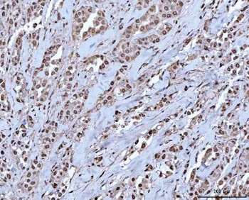 RBM15 Rabbit Polyclonal Antibody