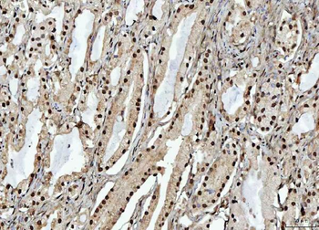 RBM15 Rabbit Polyclonal Antibody