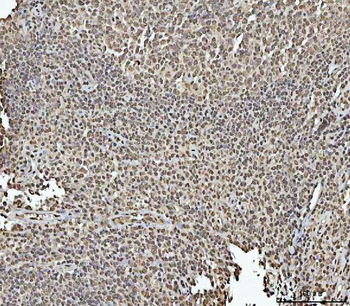 RBM15 Rabbit Polyclonal Antibody