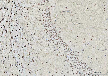 RBM15 Rabbit Polyclonal Antibody