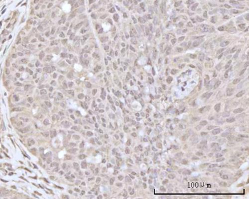 Recoverin/RCVRN Antibody