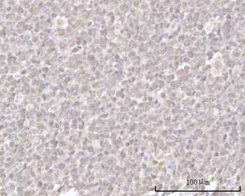 Recoverin/RCVRN Antibody