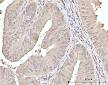 Recoverin/RCVRN Antibody