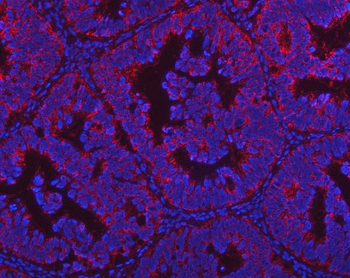 PGP Rabbit Polyclonal Antibody
