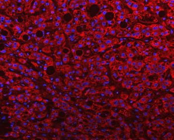 PGP Rabbit Polyclonal Antibody