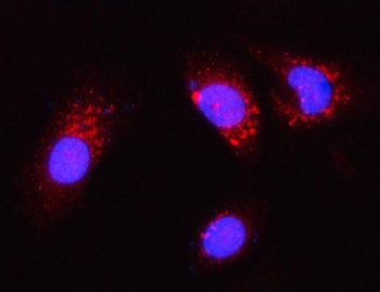 PGP Rabbit Polyclonal Antibody
