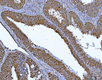 PGP Rabbit Polyclonal Antibody