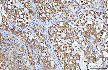 PGP Rabbit Polyclonal Antibody