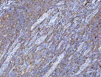 PGP Rabbit Polyclonal Antibody