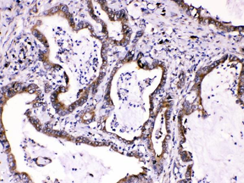Caspase 8/CASP8 Rabbit Polyclonal Antibody