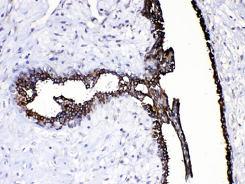 Caspase 8/CASP8 Rabbit Polyclonal Antibody