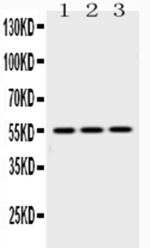 Caspase 8/CASP8 Rabbit Polyclonal Antibody