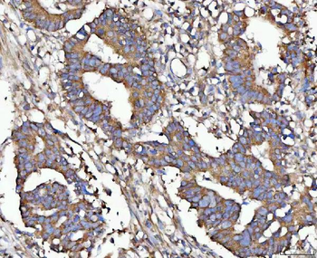 MIA3 Rabbit Polyclonal Antibody