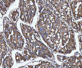 MIA3 Rabbit Polyclonal Antibody