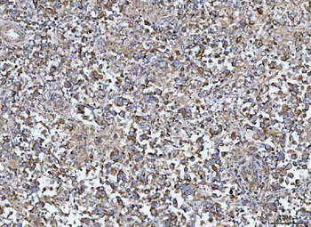 MIA3 Rabbit Polyclonal Antibody