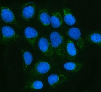 MGME1 Rabbit Polyclonal Antibody