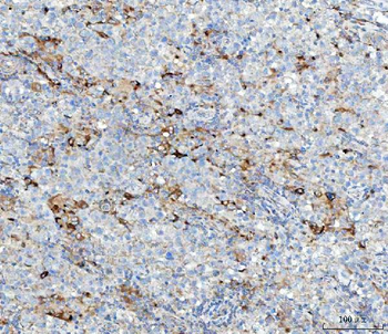 MGME1 Rabbit Polyclonal Antibody