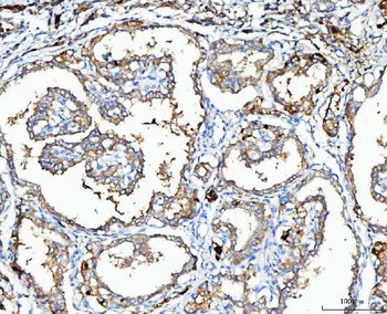 MGME1 Rabbit Polyclonal Antibody