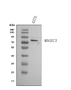 MAGEC3 Rabbit Polyclonal Antibody