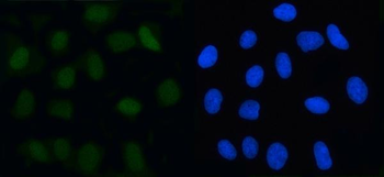 MAD2L2 Rabbit Polyclonal Antibody