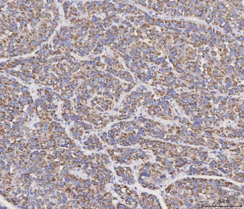 MAD2L2 Rabbit Polyclonal Antibody