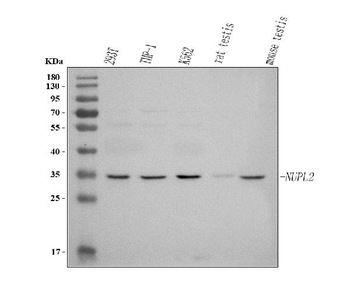 NUPL2/NUP42 Rabbit Polyclonal Antibody