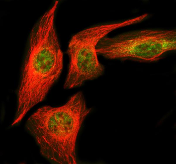 NUDT5 Rabbit Polyclonal Antibody