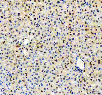 NUDT5 Rabbit Polyclonal Antibody