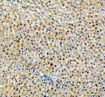 NUDT5 Rabbit Polyclonal Antibody