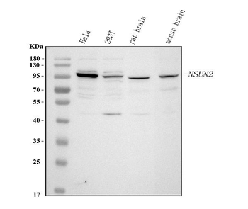 NSUN2 Rabbit Polyclonal Antibody