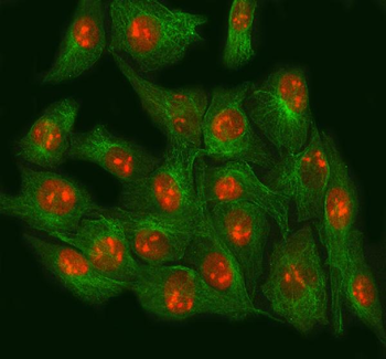 NSUN2 Rabbit Polyclonal Antibody