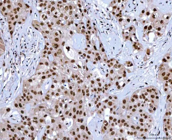 NSUN2 Rabbit Polyclonal Antibody