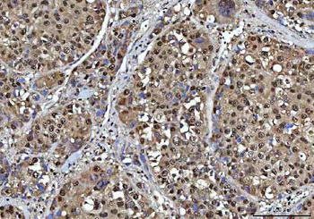 NSUN2 Rabbit Polyclonal Antibody