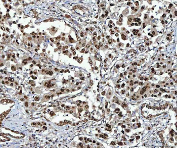 NSUN2 Rabbit Polyclonal Antibody