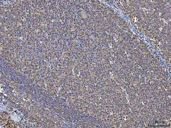 NSUN2 Rabbit Polyclonal Antibody