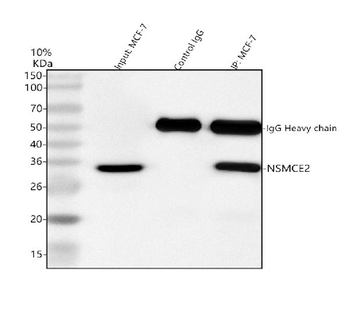 NSMCE2 Rabbit Polyclonal Antibody