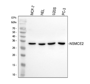 NSMCE2 Rabbit Polyclonal Antibody
