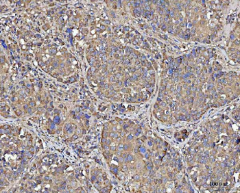 MECR Rabbit Polyclonal Antibody