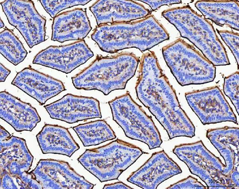 MGAM Rabbit Polyclonal Antibody