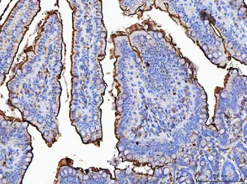MGAM Rabbit Polyclonal Antibody