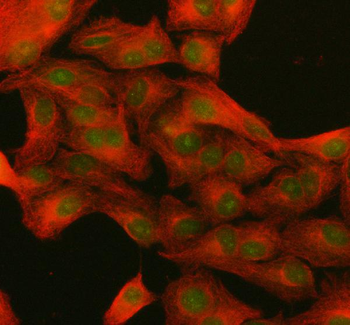 NUP133 Rabbit Polyclonal Antibody