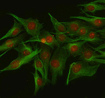 NUP133 Rabbit Polyclonal Antibody