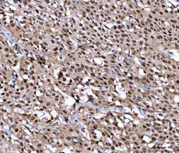 NUP37 Rabbit Polyclonal Antibody