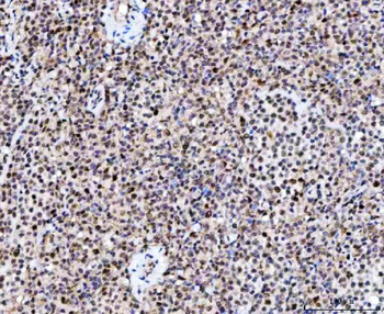 NUP37 Rabbit Polyclonal Antibody