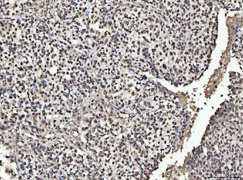 NUMA/NUMA1 Rabbit Polyclonal Antibody