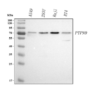 PTPN9 Rabbit Polyclonal Antibody