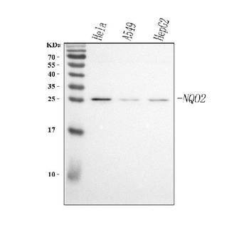 NQO2 Rabbit Polyclonal Antibody