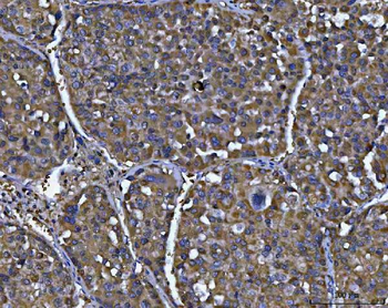 NIT2 Rabbit Polyclonal Antibody