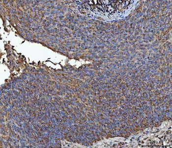 NIT2 Rabbit Polyclonal Antibody