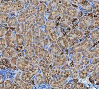 NIT2 Rabbit Polyclonal Antibody